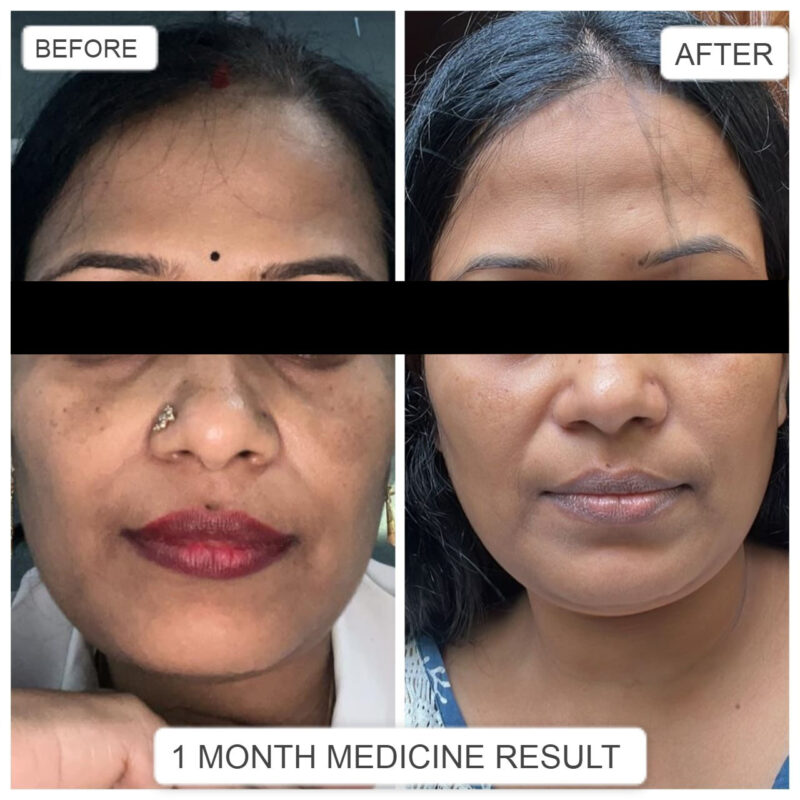 Anti Aging Cream Reduce wrinkles Repair sun damage - Image 4