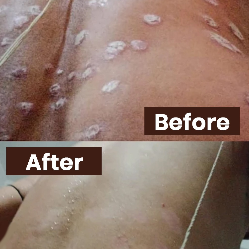 Skin Healing Cream - Image 4